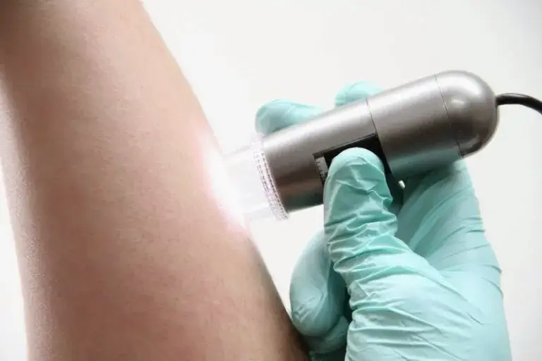 Skin Specialists Improving Skin Health in Carindale