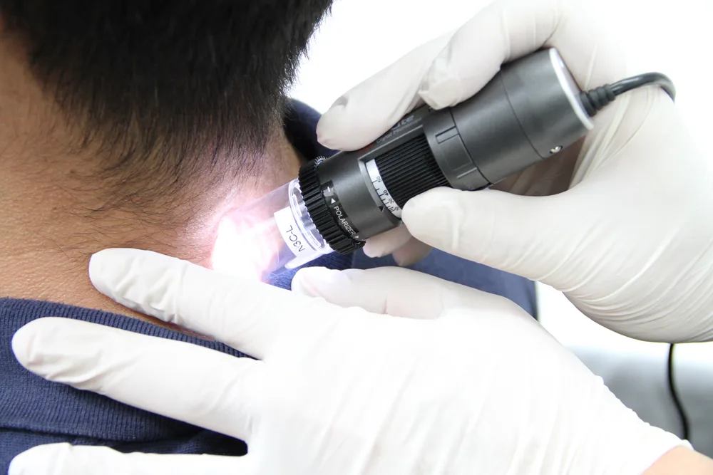dino-lite skin check technology