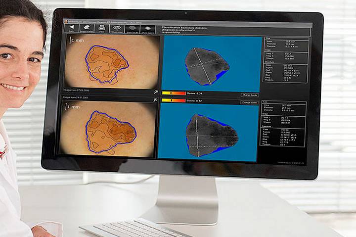 skin check imaging skin health carindale garden city